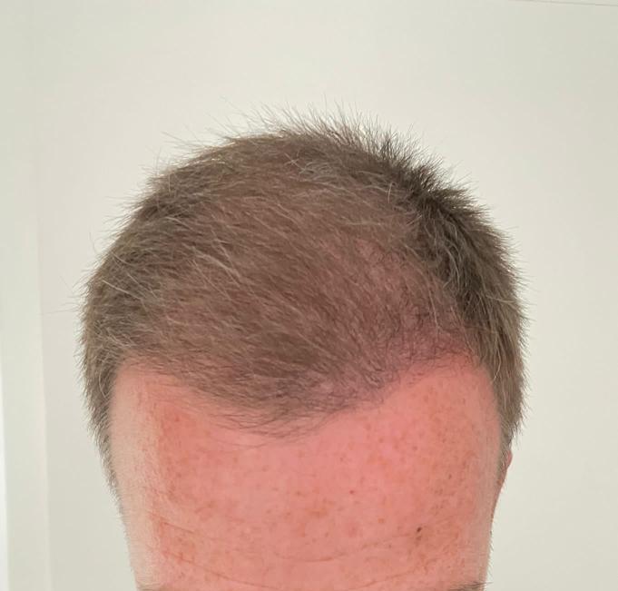 /foren/transplant/index.php/fa/58932/0/