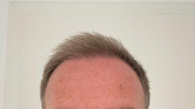 /foren/transplant/index.php/fa/58933/0/