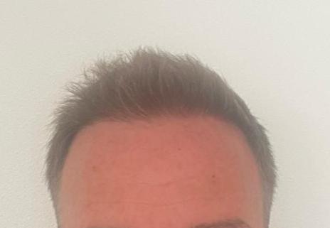 /foren/transplant/index.php/fa/58934/0/