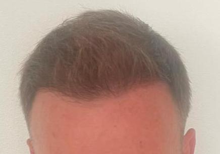 /foren/transplant/index.php/fa/58935/0/