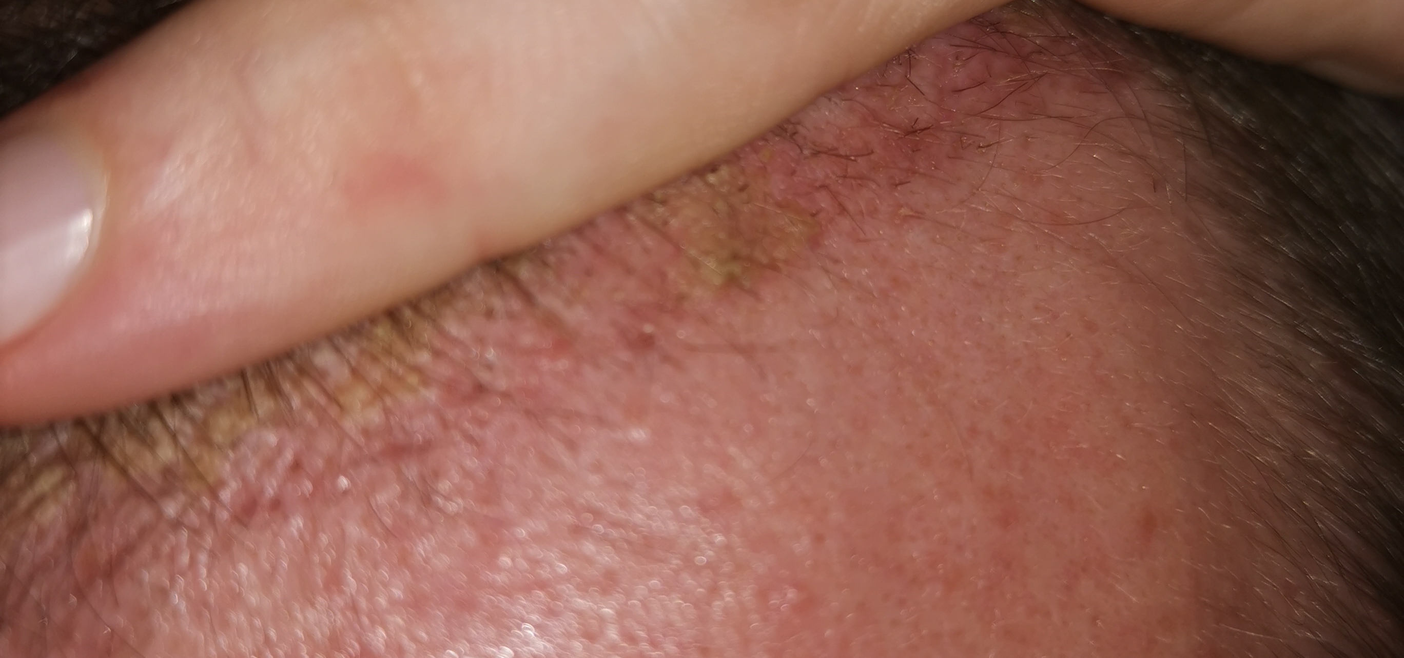 /foren/transplant/index.php/fa/58947/0/