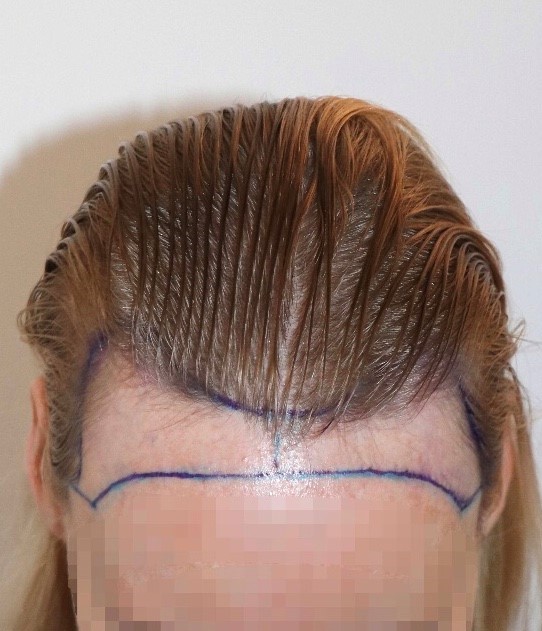 /foren/transplant/index.php/fa/58983/0/