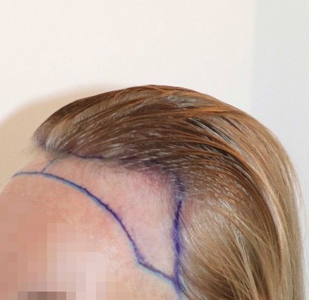 /foren/transplant/index.php/fa/58984/0/