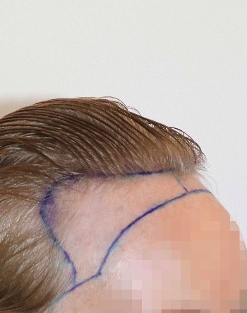 /foren/transplant/index.php/fa/58985/0/