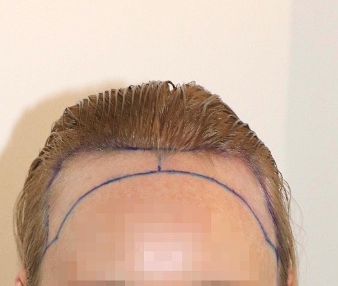 /foren/transplant/index.php/fa/58986/0/