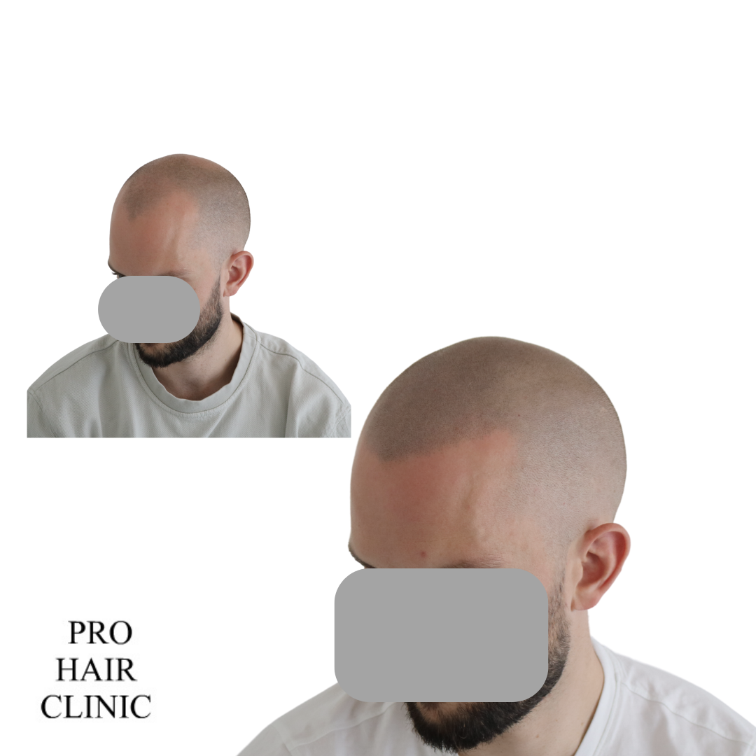 /foren/transplant/index.php/fa/59245/0/