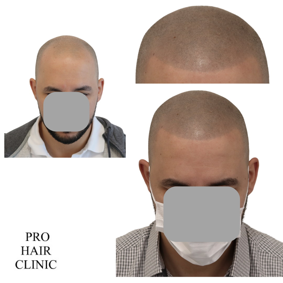 /foren/transplant/index.php/fa/59307/0/