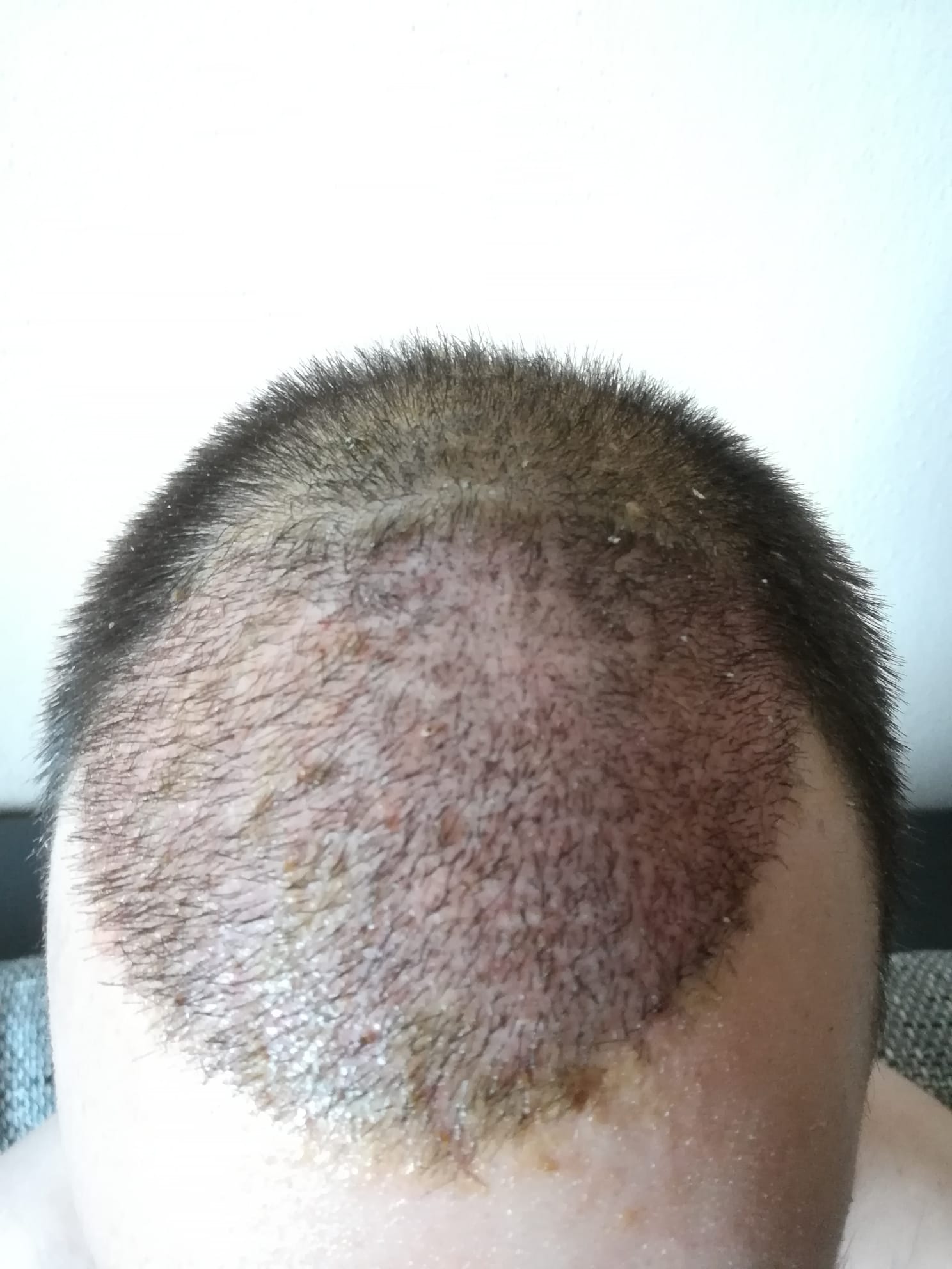 /foren/transplant/index.php/fa/59378/0/