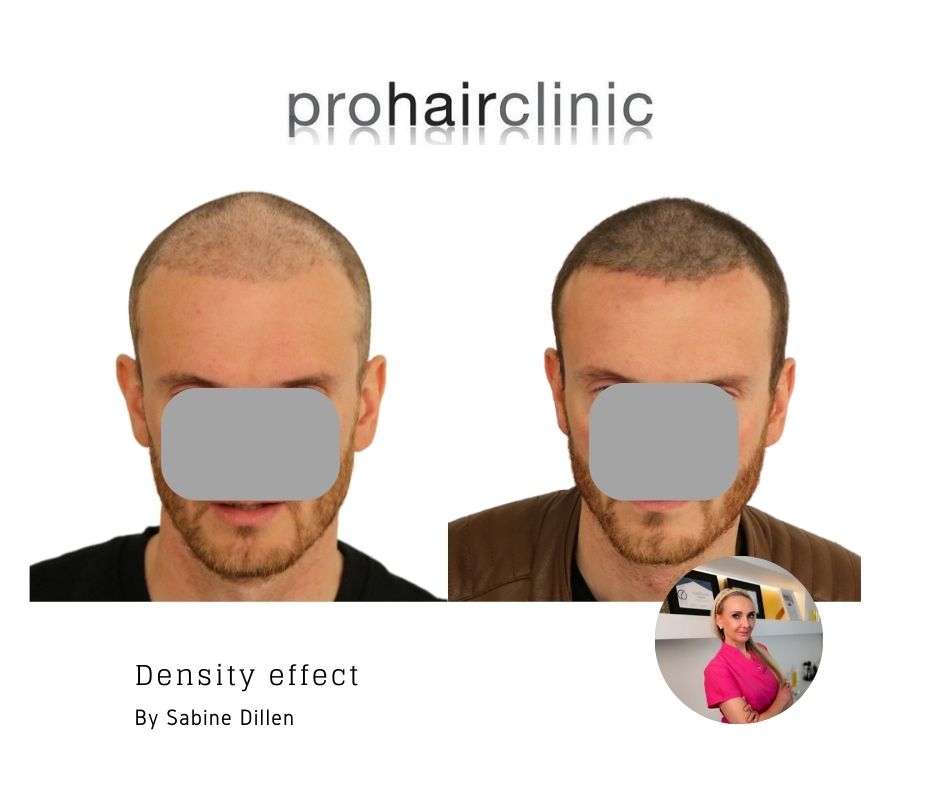 /foren/transplant/index.php/fa/59423/0/