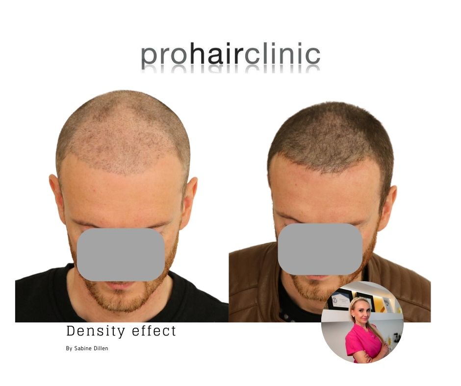 /foren/transplant/index.php/fa/59424/0/