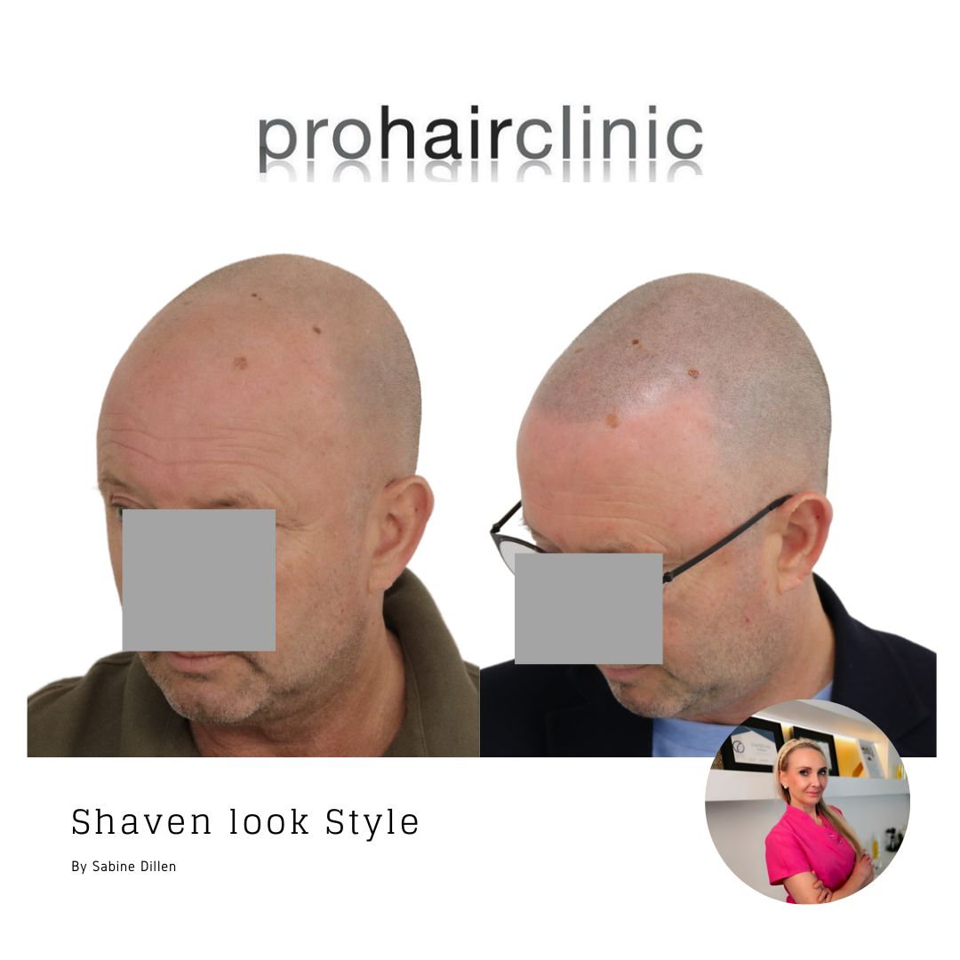 /foren/transplant/index.php/fa/59442/0/