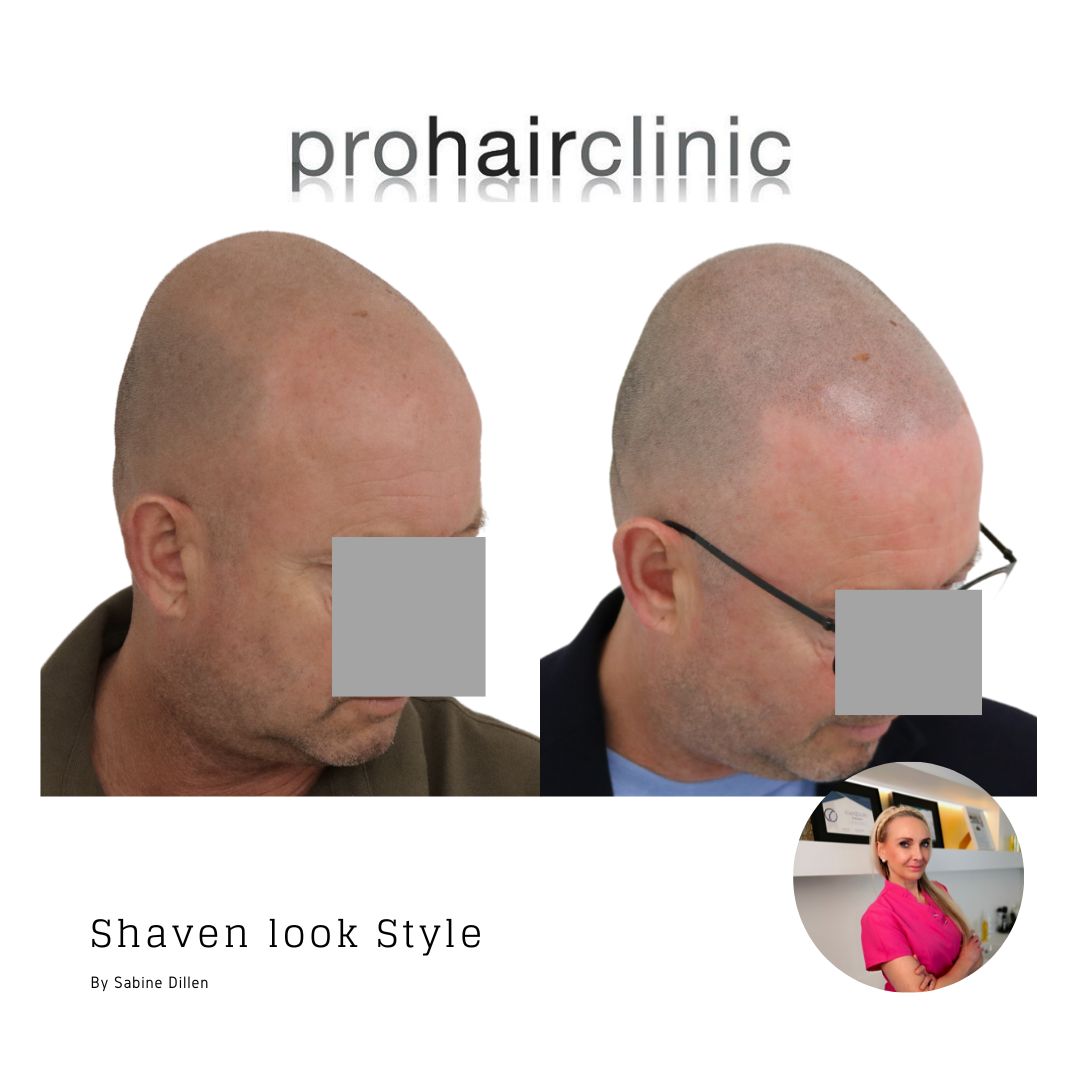 /foren/transplant/index.php/fa/59443/0/