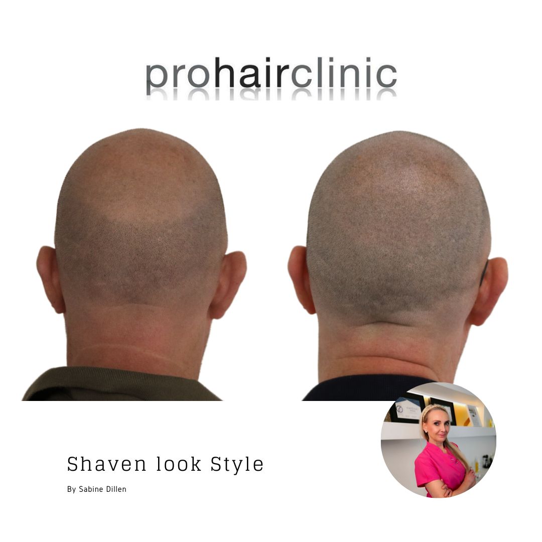 /foren/transplant/index.php/fa/59444/0/