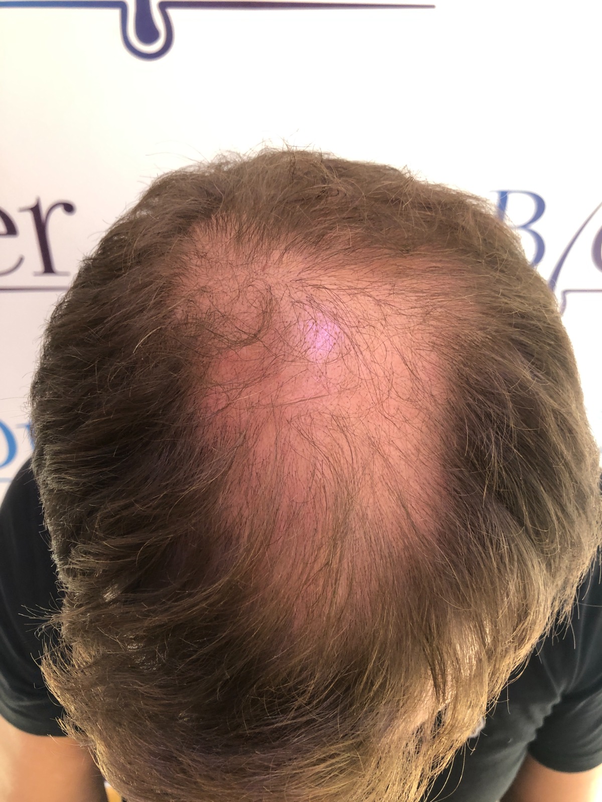 /foren/transplant/index.php/fa/59489/0/