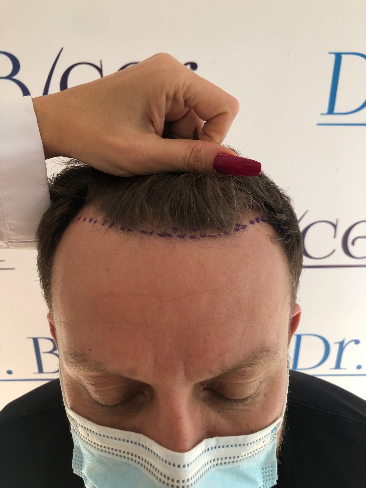 /foren/transplant/index.php/fa/59490/0/