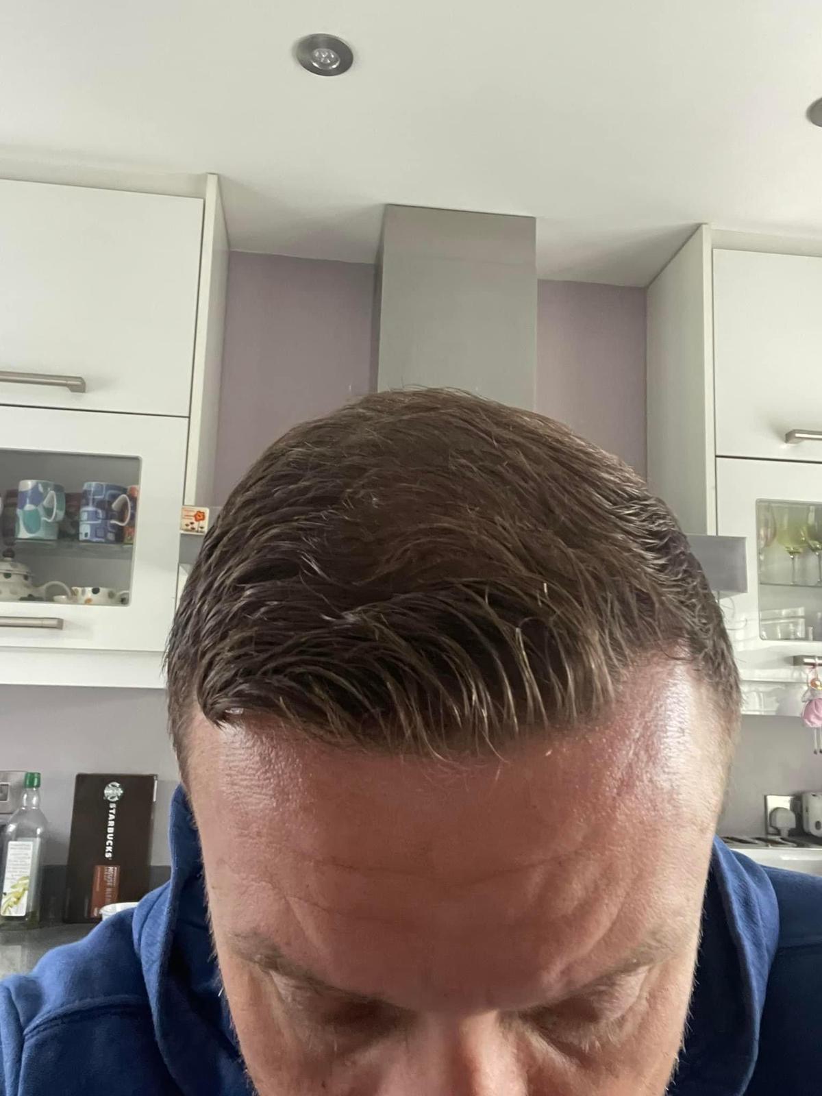 /foren/transplant/index.php/fa/59498/0/