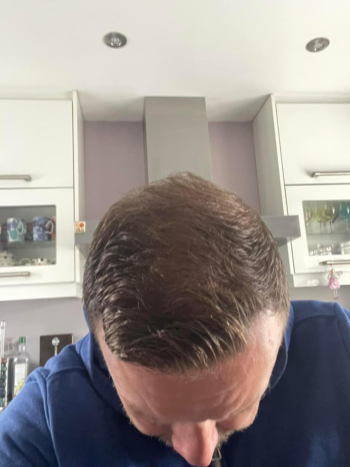 /foren/transplant/index.php/fa/59499/0/