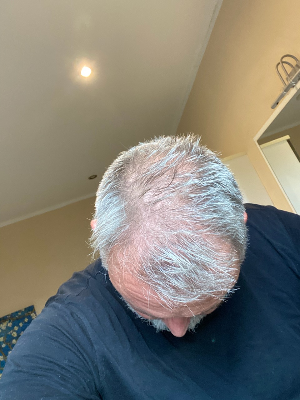 /foren/transplant/index.php/fa/59512/0/