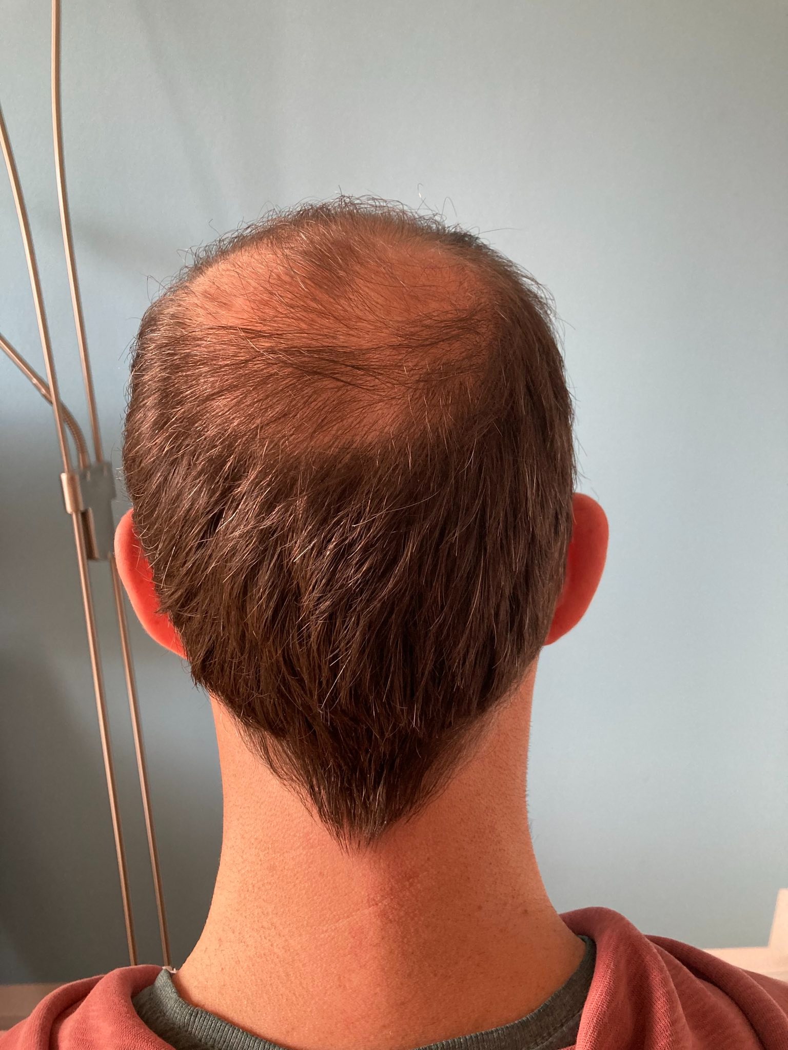 /foren/transplant/index.php/fa/59592/0/