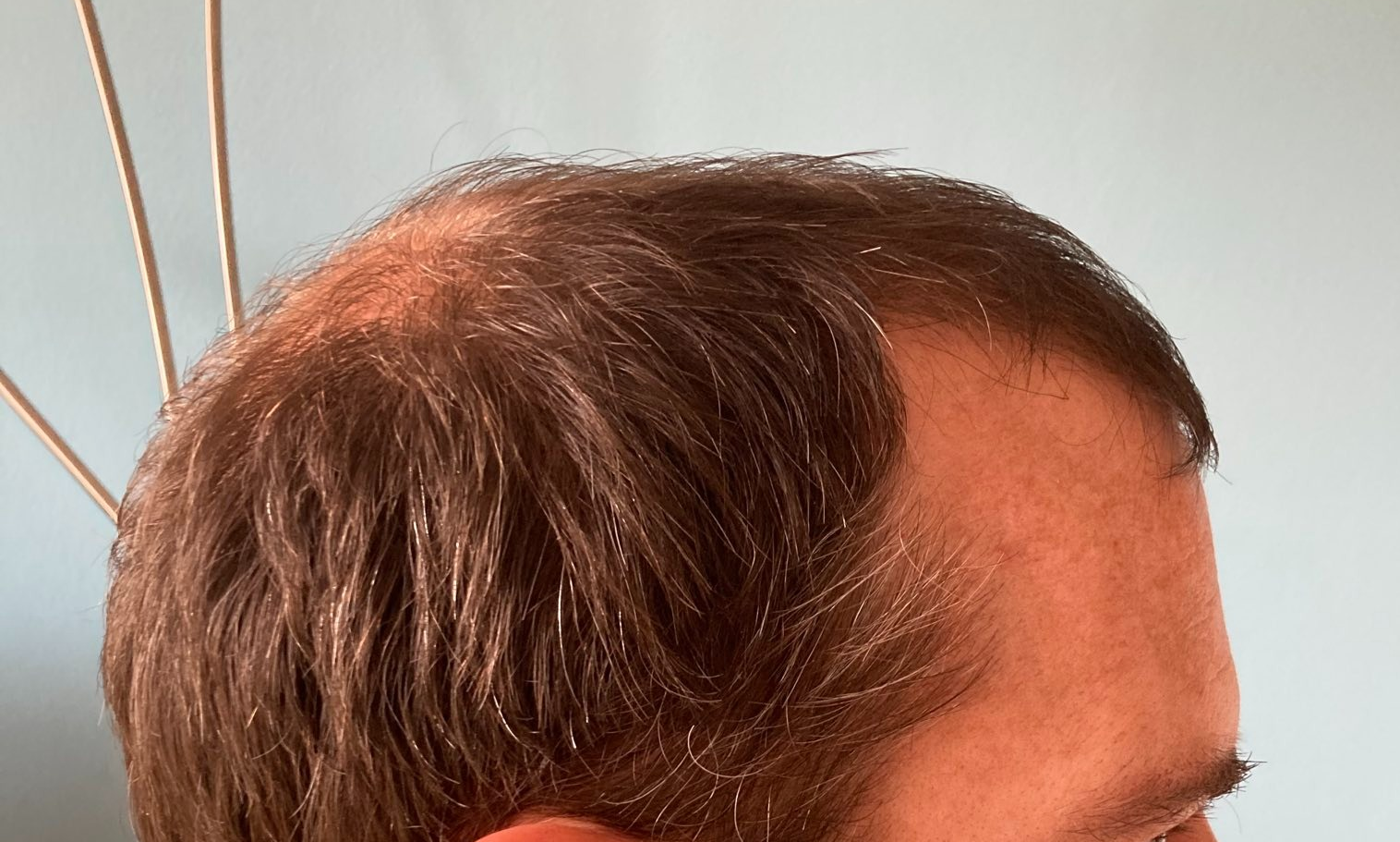 /foren/transplant/index.php/fa/59595/0/