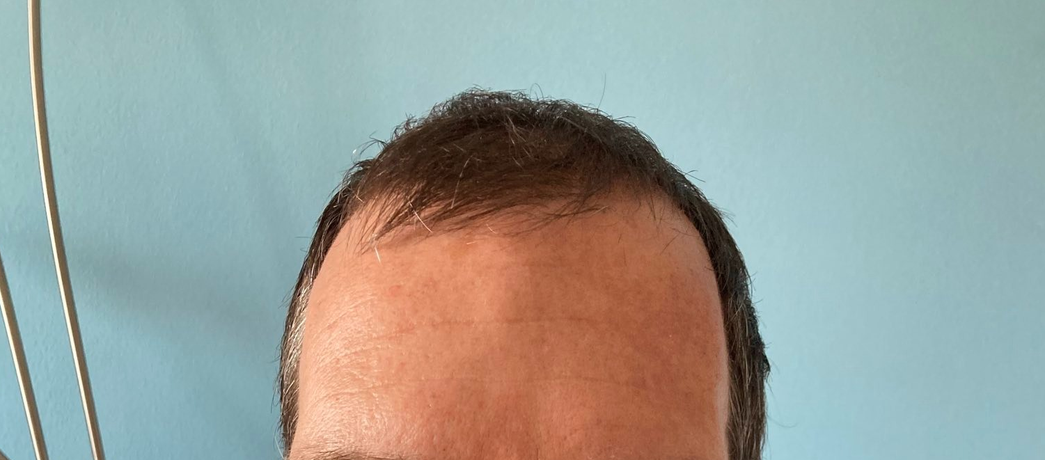 /foren/transplant/index.php/fa/59596/0/