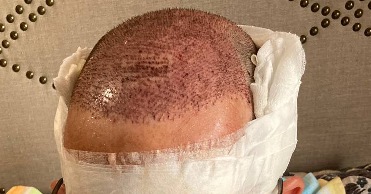 /foren/transplant/index.php/fa/59597/0/