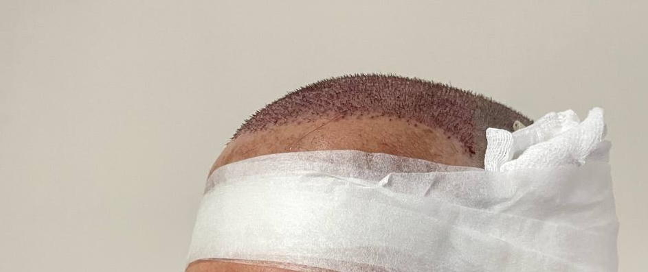 /foren/transplant/index.php/fa/59600/0/