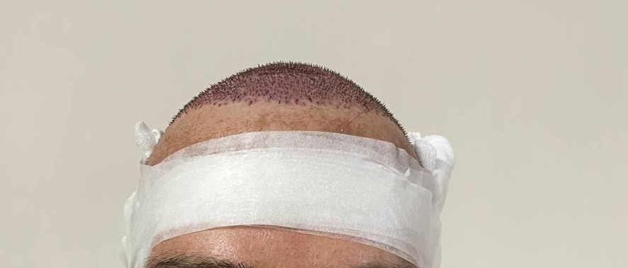 /foren/transplant/index.php/fa/59602/0/