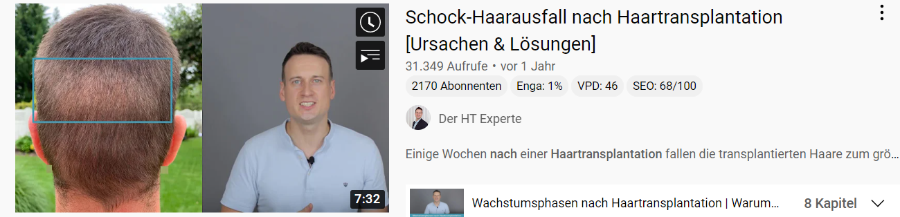 /foren/transplant/index.php/fa/59631/0/