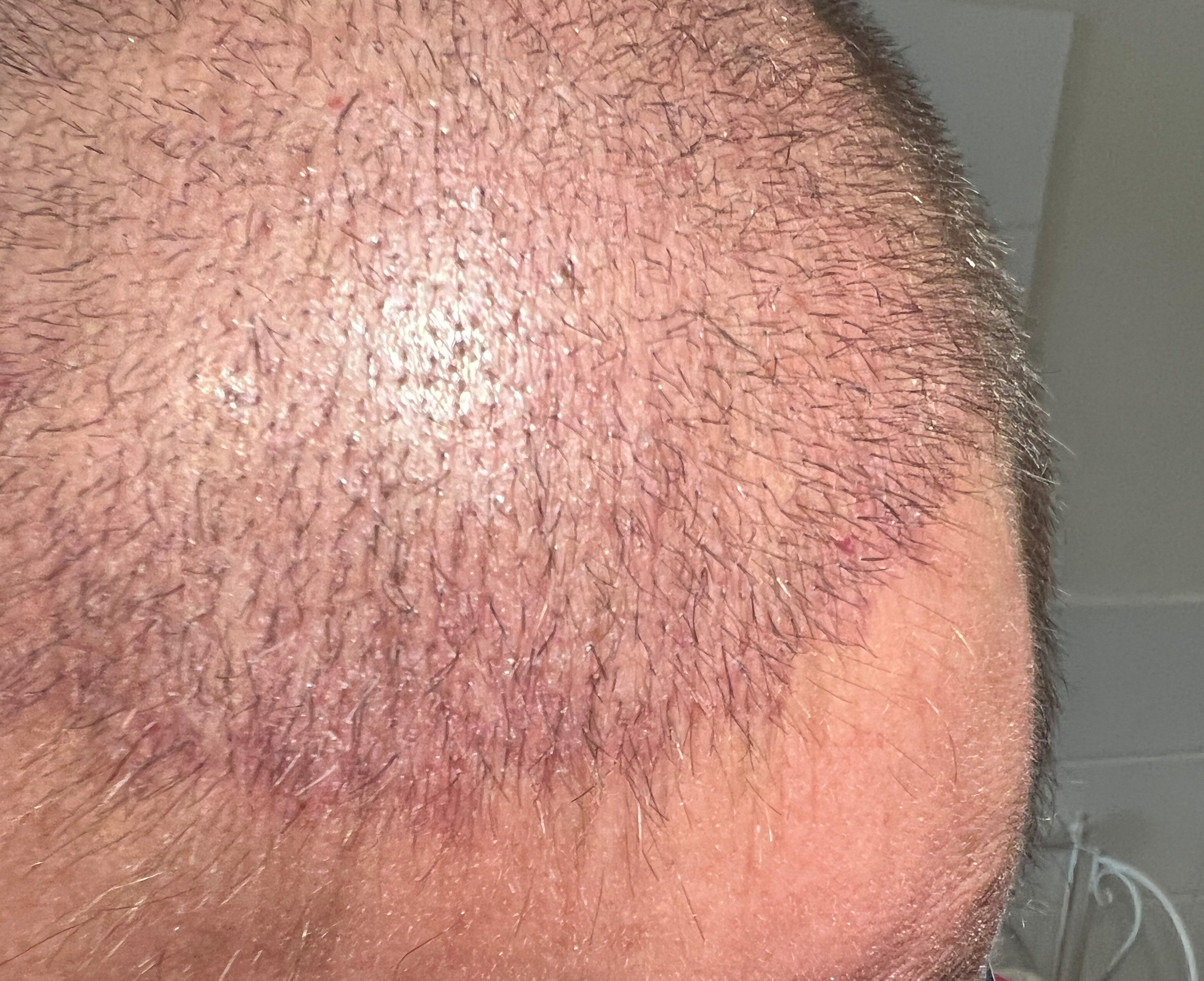 /foren/transplant/index.php/fa/59643/0/