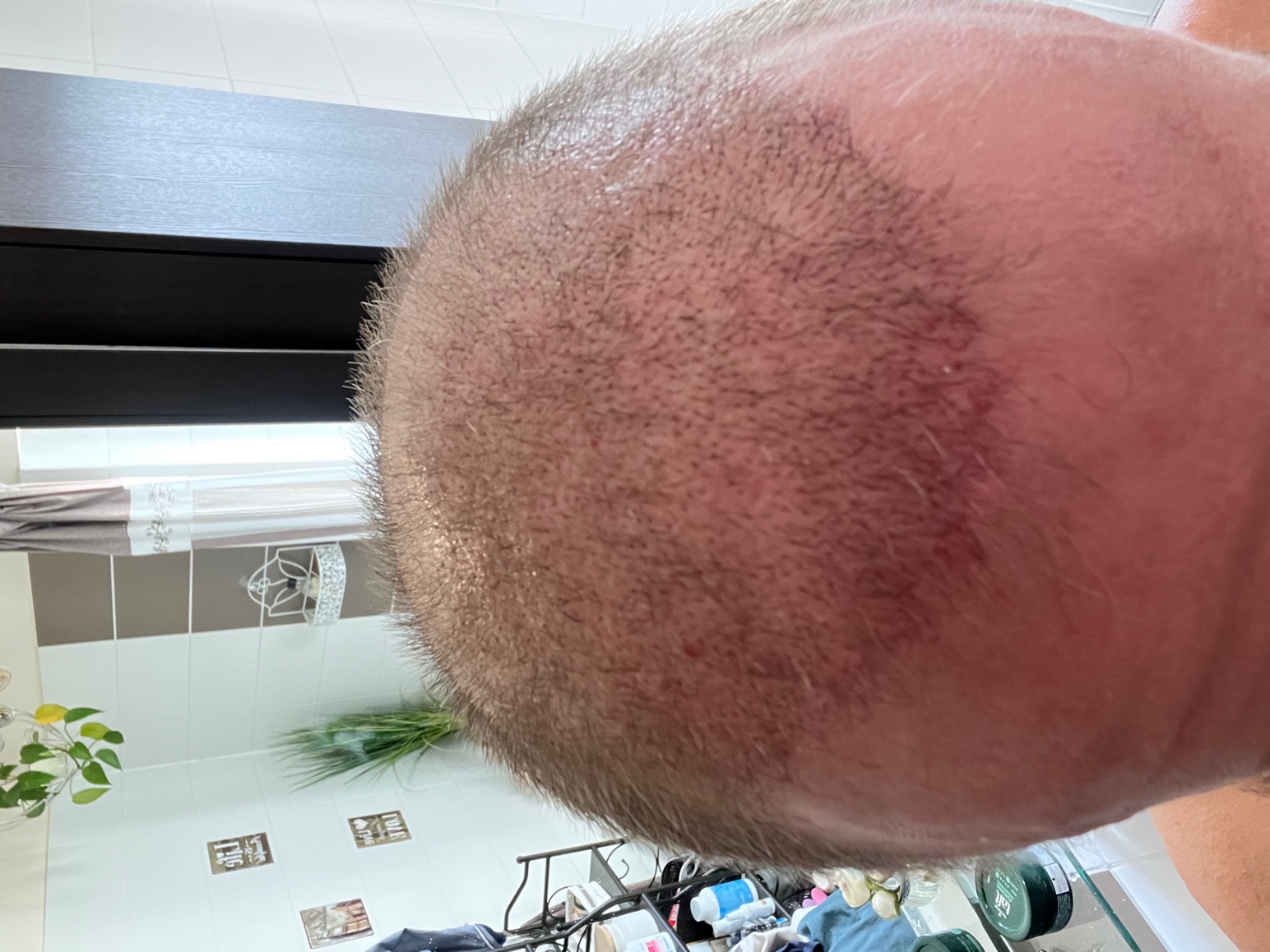 /foren/transplant/index.php/fa/59644/0/