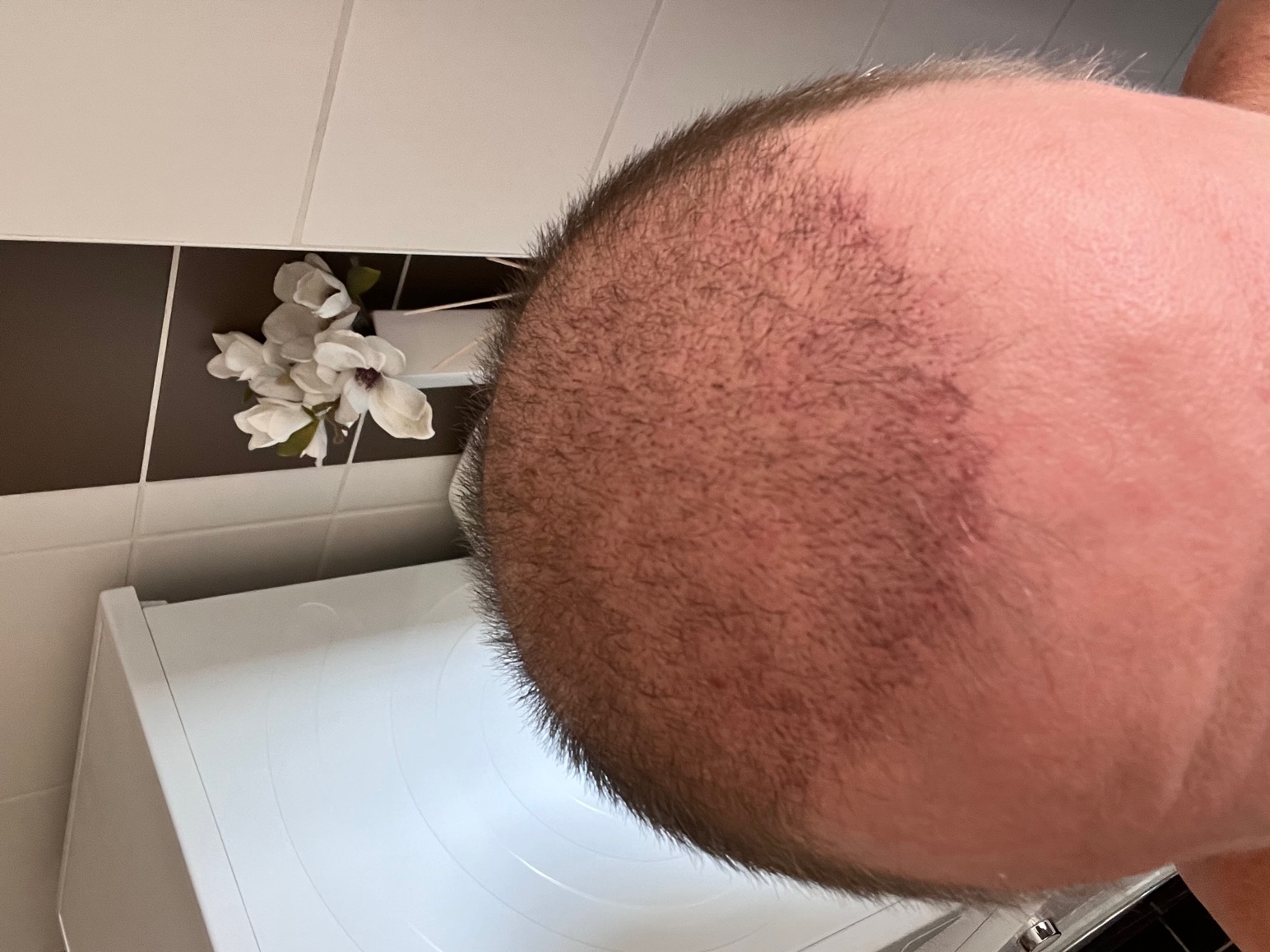 /foren/transplant/index.php/fa/59645/0/