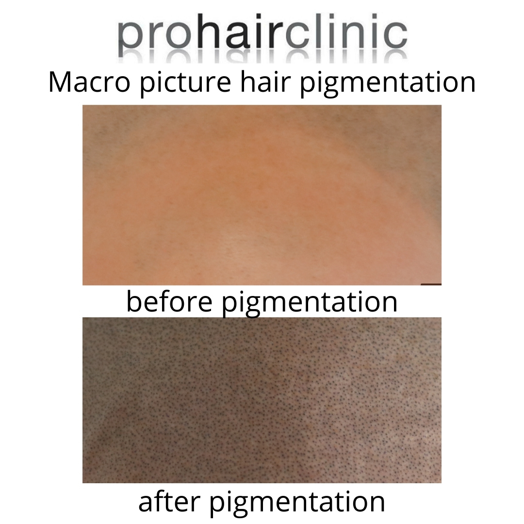 /foren/transplant/index.php/fa/59687/0/