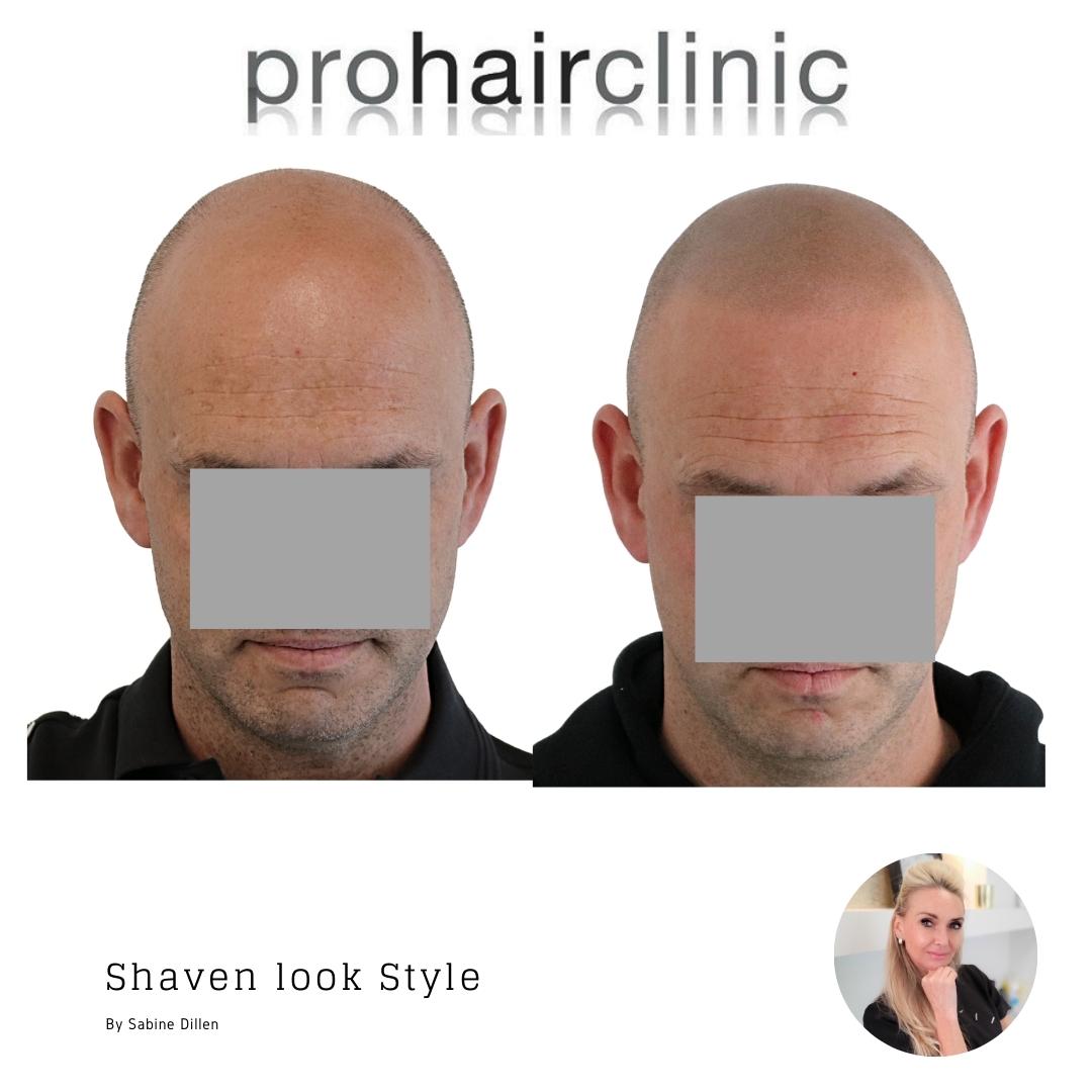 /foren/transplant/index.php/fa/59763/0/