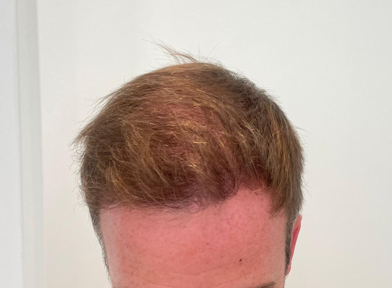 /foren/transplant/index.php/fa/59768/0/