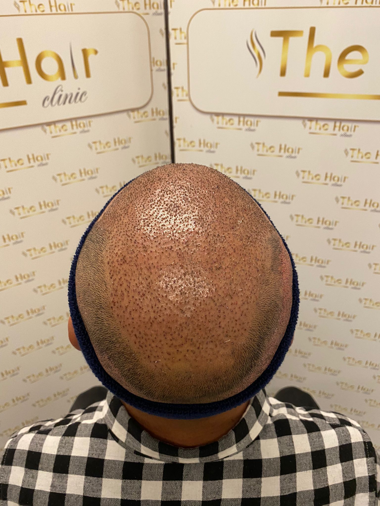 /foren/transplant/index.php/fa/59787/0/