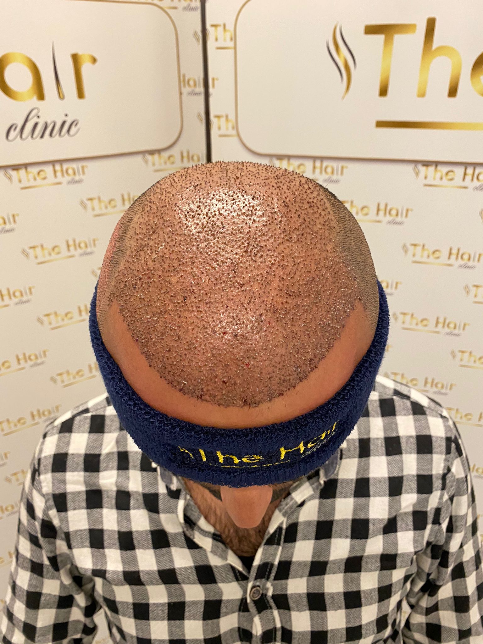 /foren/transplant/index.php/fa/59788/0/