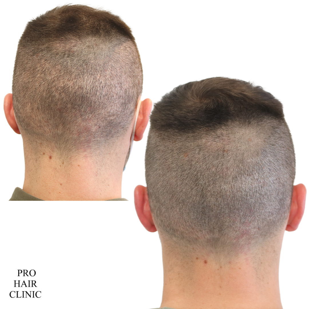 /foren/transplant/index.php/fa/59826/0/