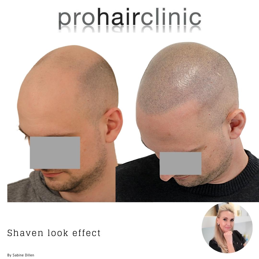 /foren/transplant/index.php/fa/59874/0/