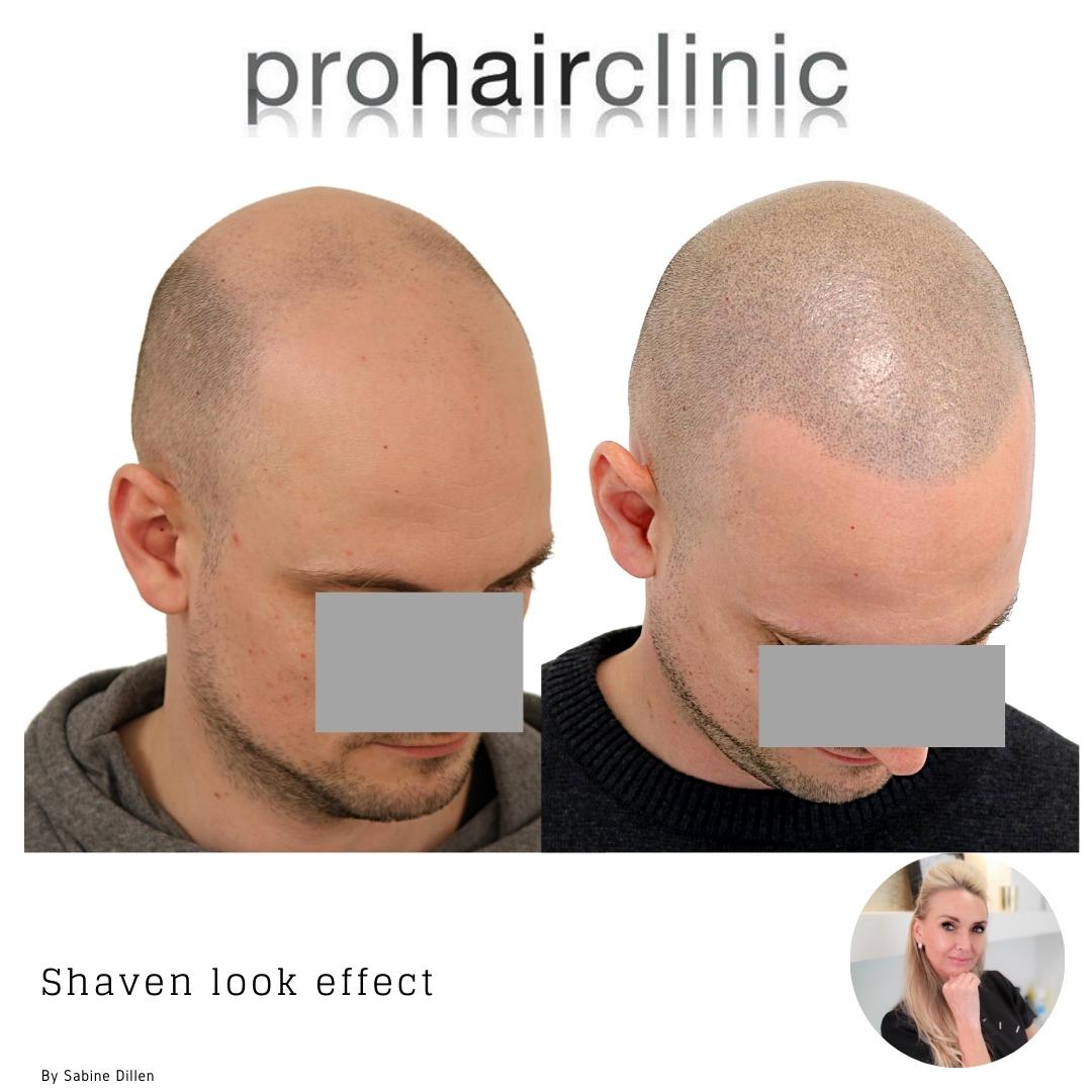 /foren/transplant/index.php/fa/59875/0/