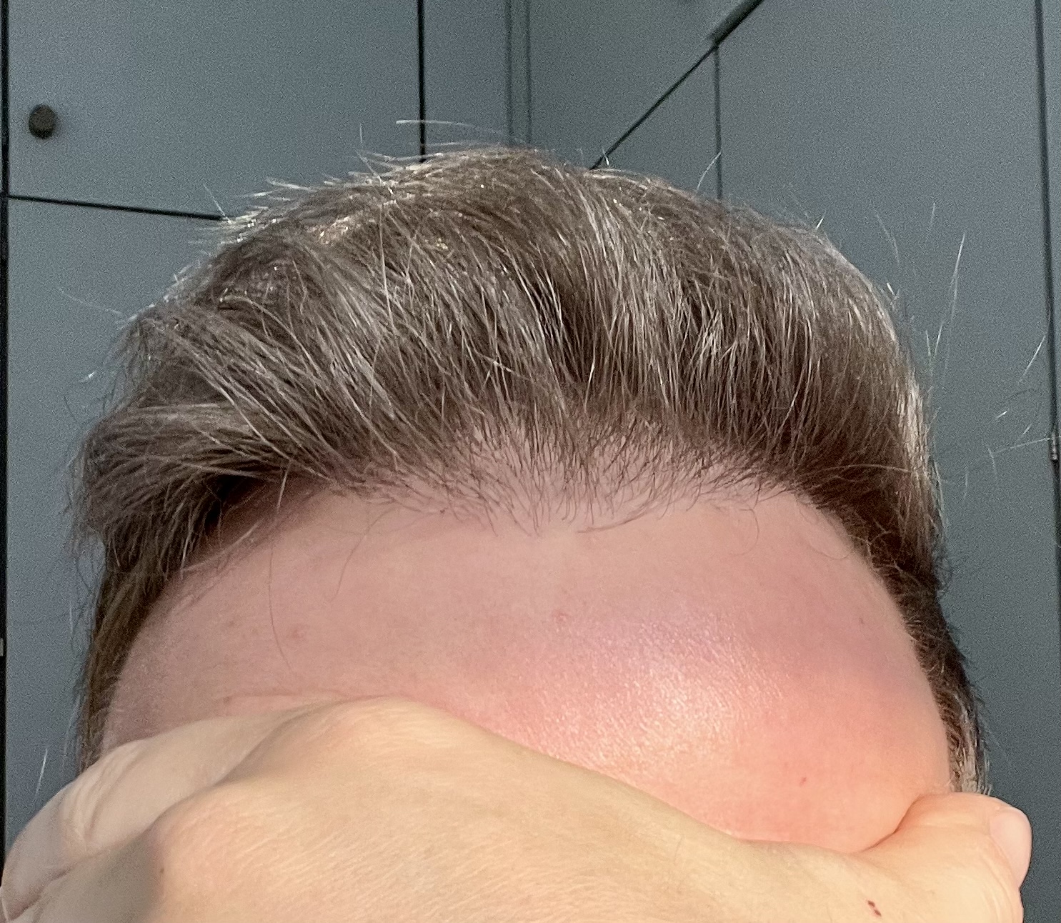 /foren/transplant/index.php/fa/59917/0/