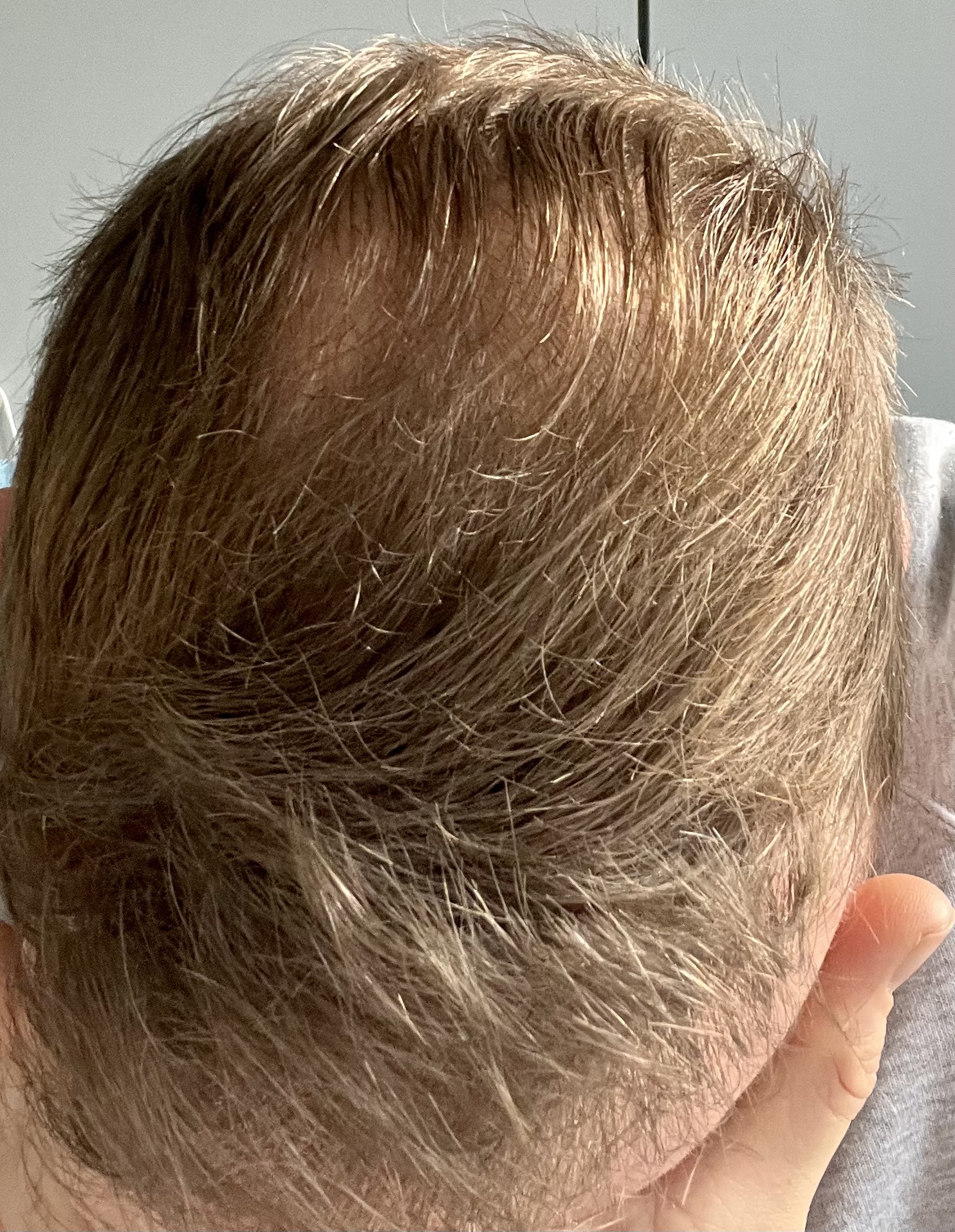 /foren/transplant/index.php/fa/59919/0/