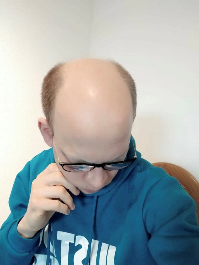 /foren/transplant/index.php/fa/59982/0/