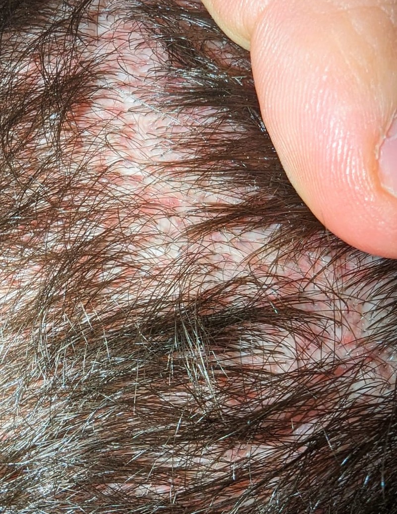 /foren/transplant/index.php/fa/60081/0/