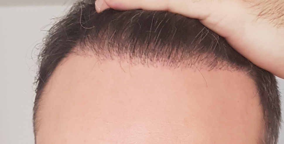 /foren/transplant/index.php/fa/60241/0/