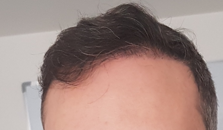 /foren/transplant/index.php/fa/60242/0/