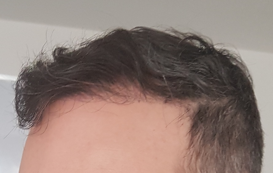 /foren/transplant/index.php/fa/60243/0/