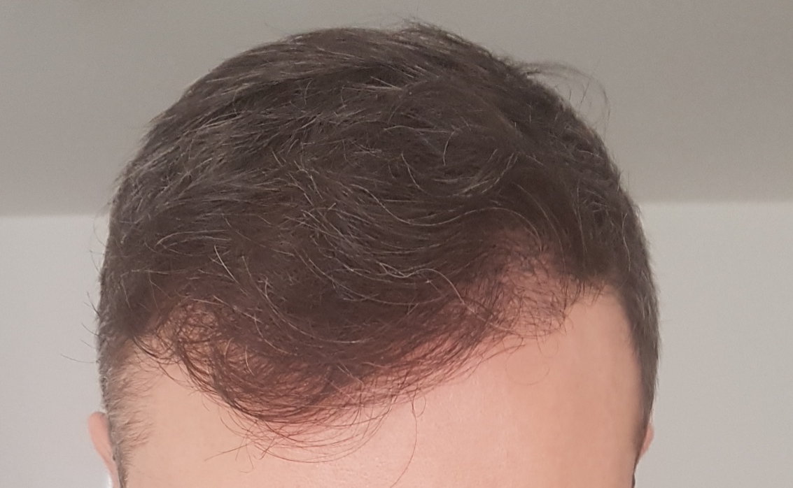 /foren/transplant/index.php/fa/60245/0/