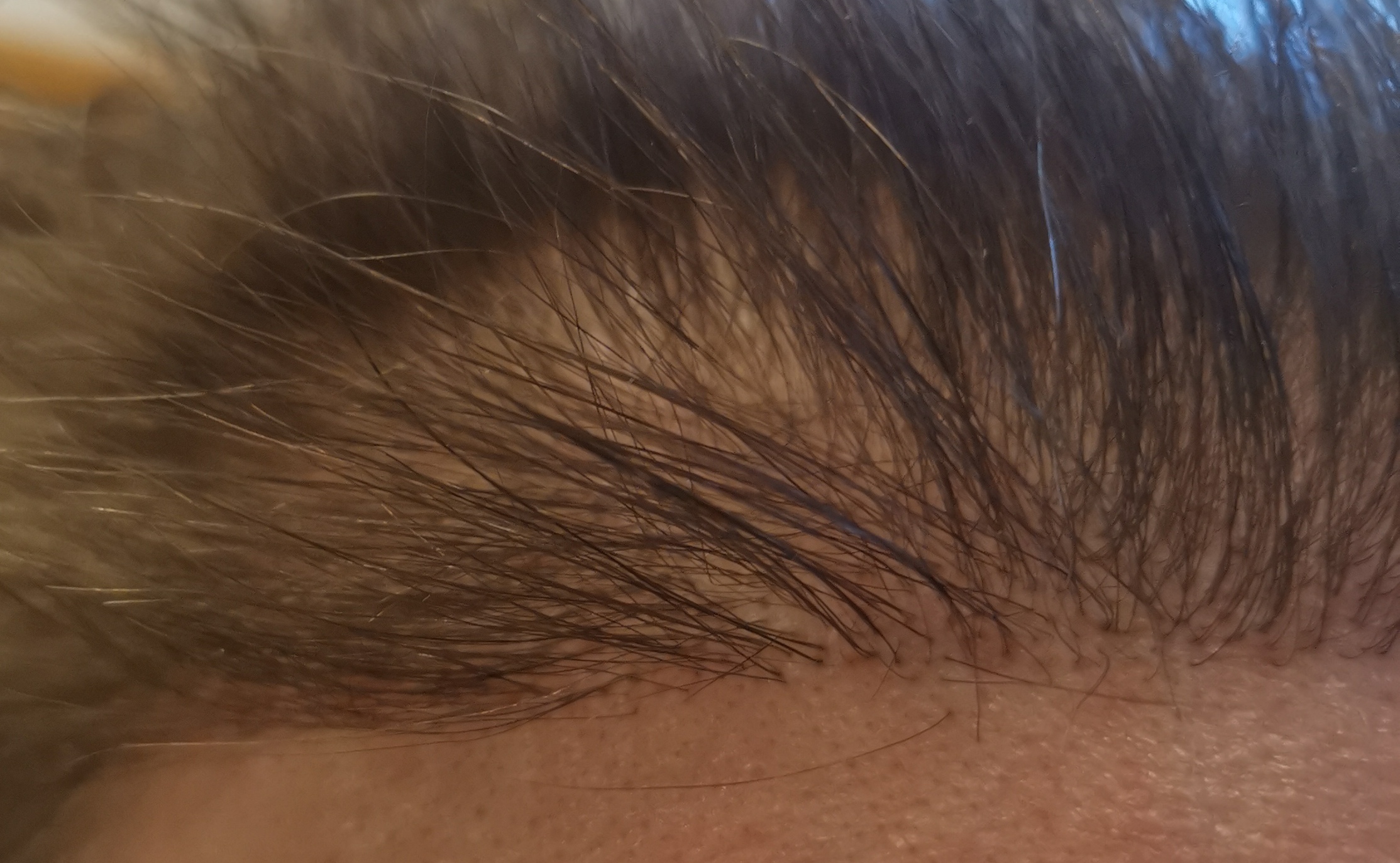 /foren/transplant/index.php/fa/60368/0/