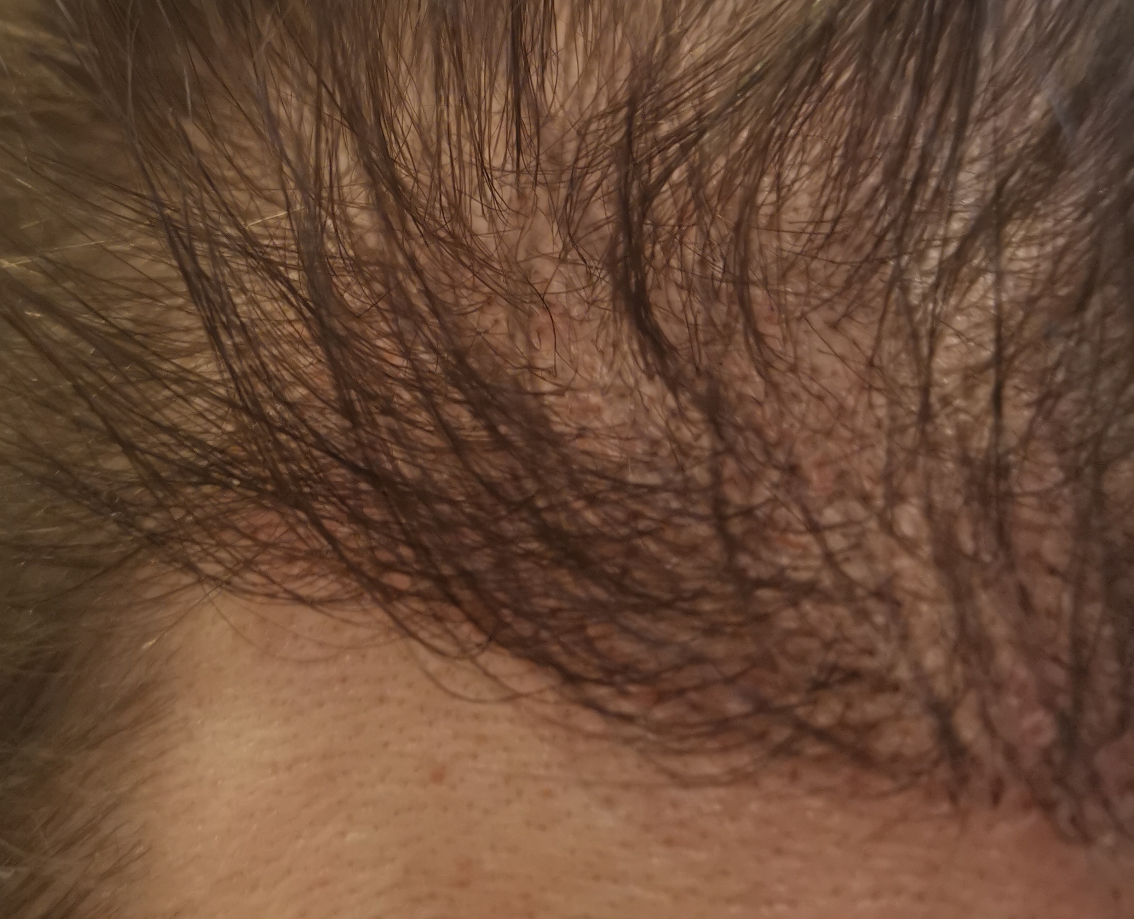 /foren/transplant/index.php/fa/60370/0/